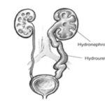 Nephrology